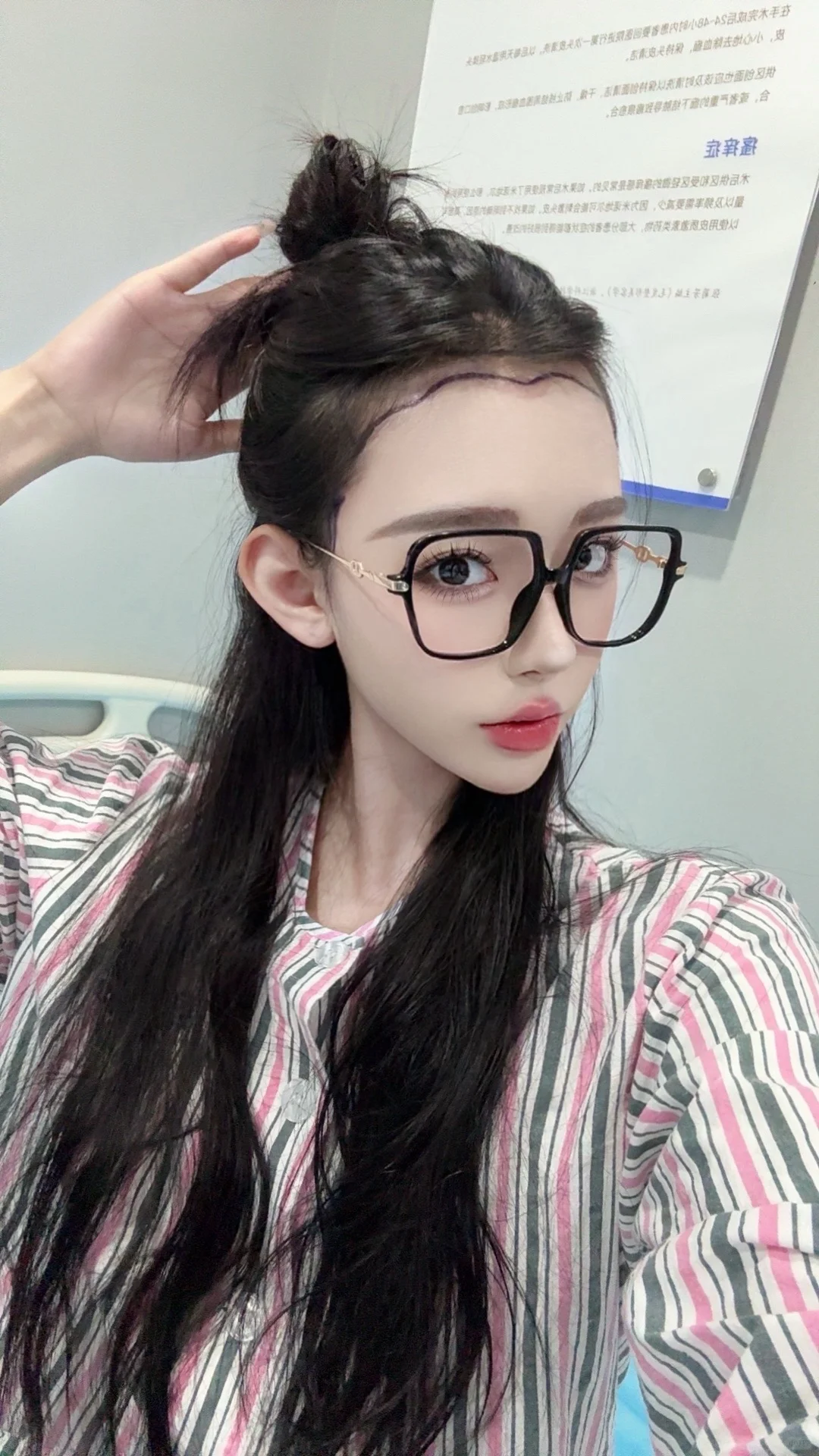 植发Plog👧🏻头包脸的养成秘诀