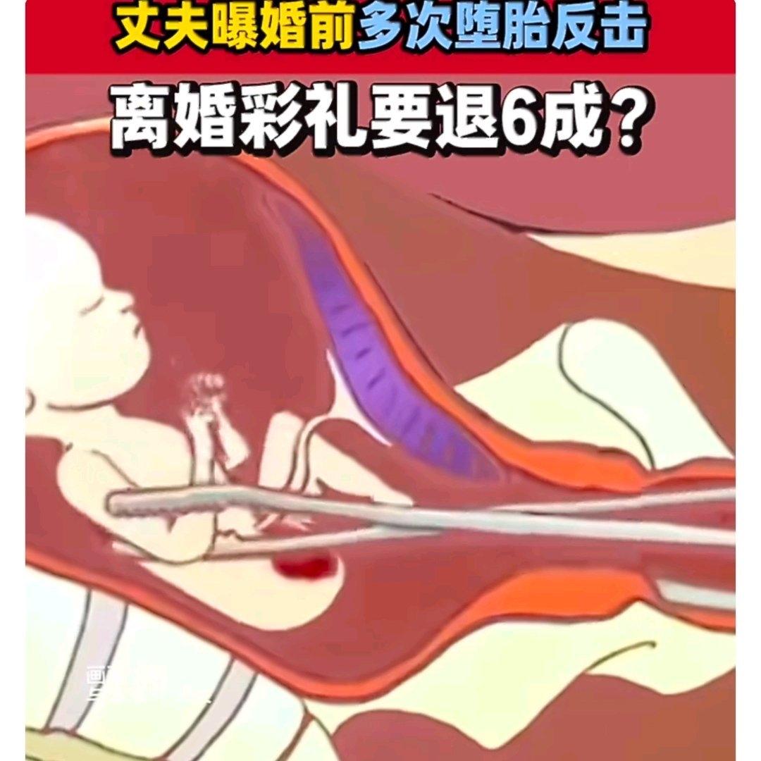 看这桩婚约财产纠纷，真是让人唏嘘又感慨。一对经人介绍订婚的男女，男方花了十万多彩