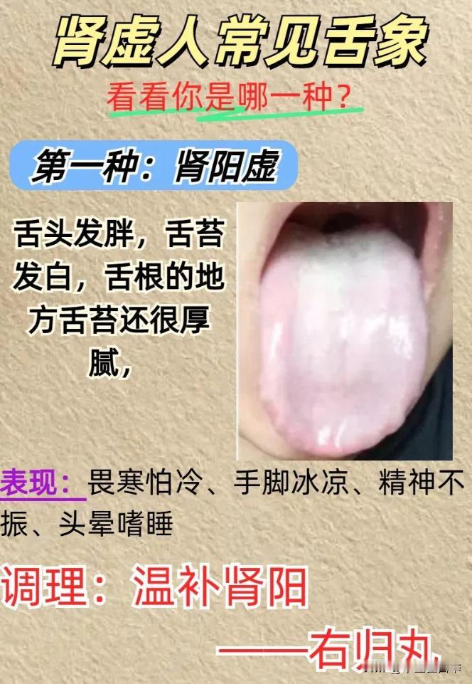 肾虚的人常见四种舌象，对照一下你是哪一种？
一：肾阳虚
二：肾阴虚
三：肾气虚