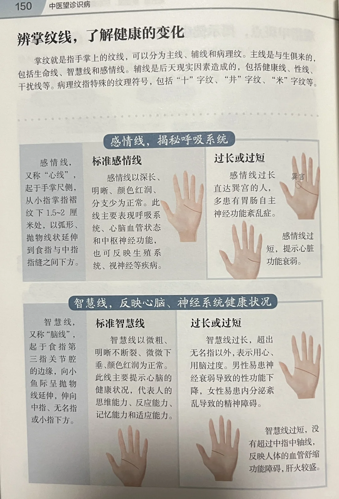 看手相识病