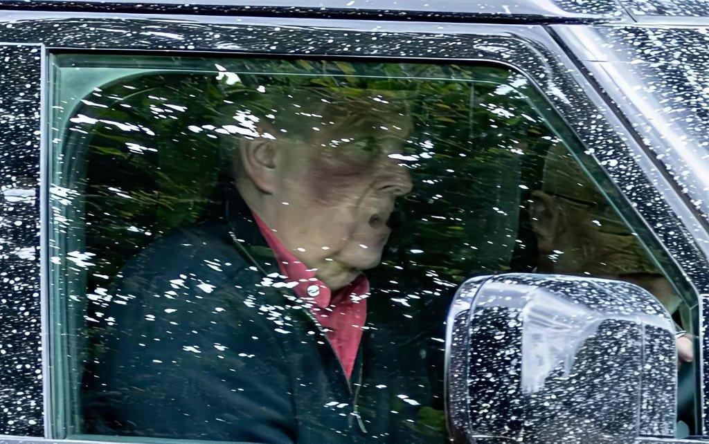 遭英国王室除名的前王子安庶人被拍到满脸血淤 