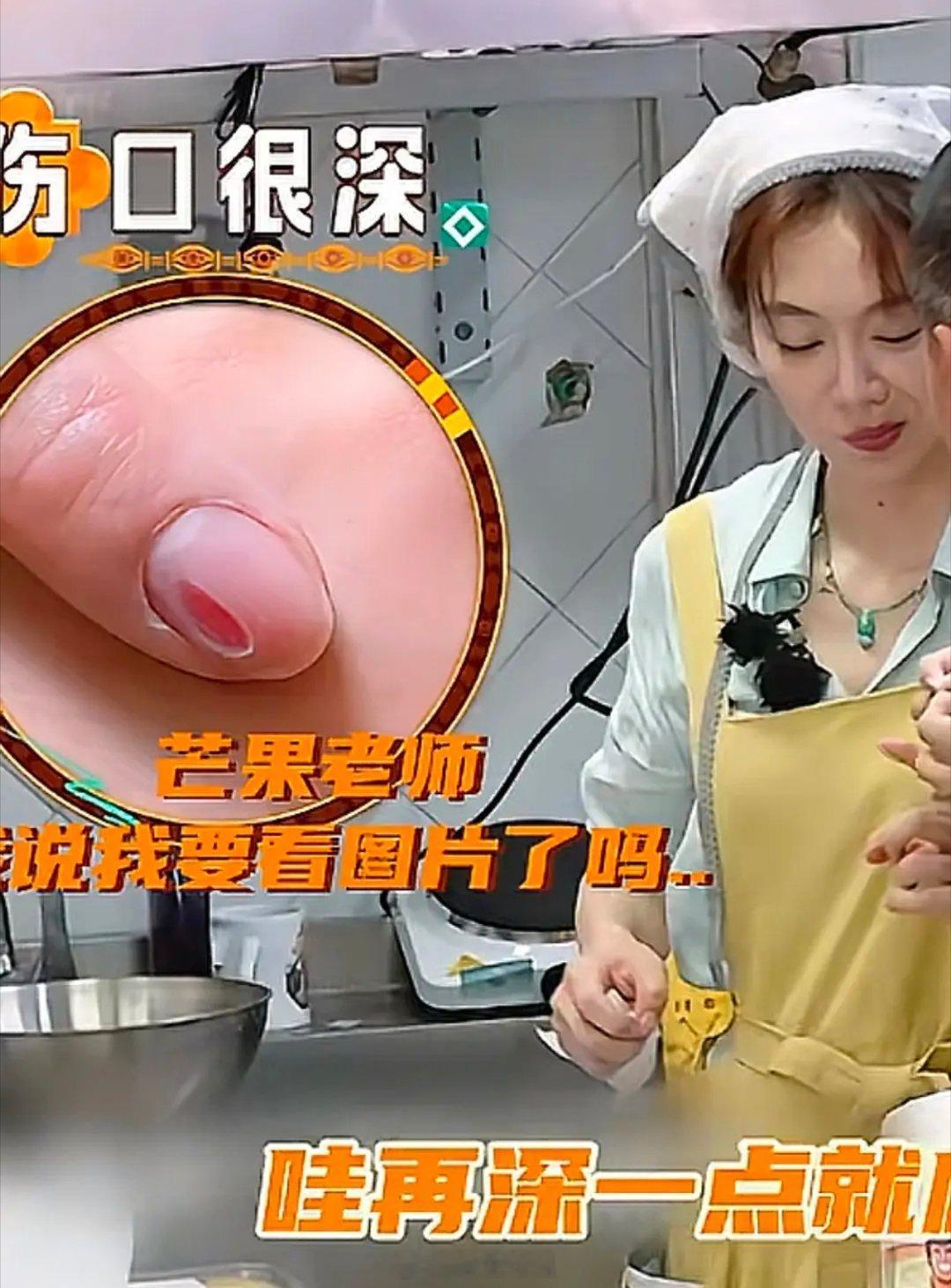中餐厅姜妍受伤，她切到指甲了，看着就好痛长这样 ​​​