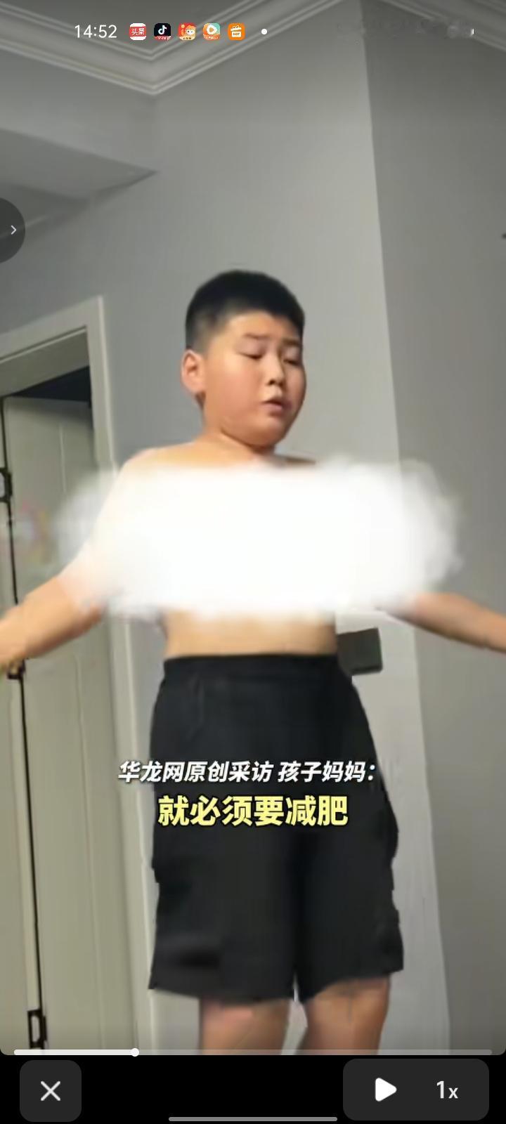 8月28日，重庆。13岁男孩因肥胖影响发育和身高，下定决心减肥，减肥前他是142