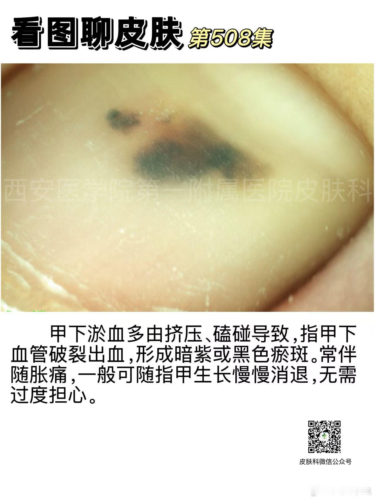 分享图片
