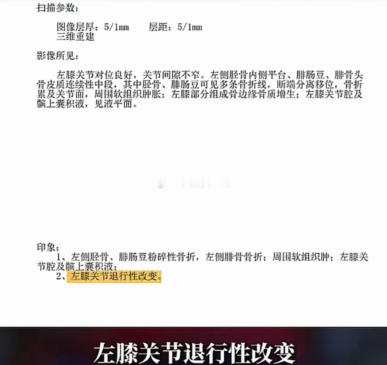 周鸿祎拿着骨折报告单，居然说：“左膝关节退行性改变，不知这啥意思。“左膝关节退行