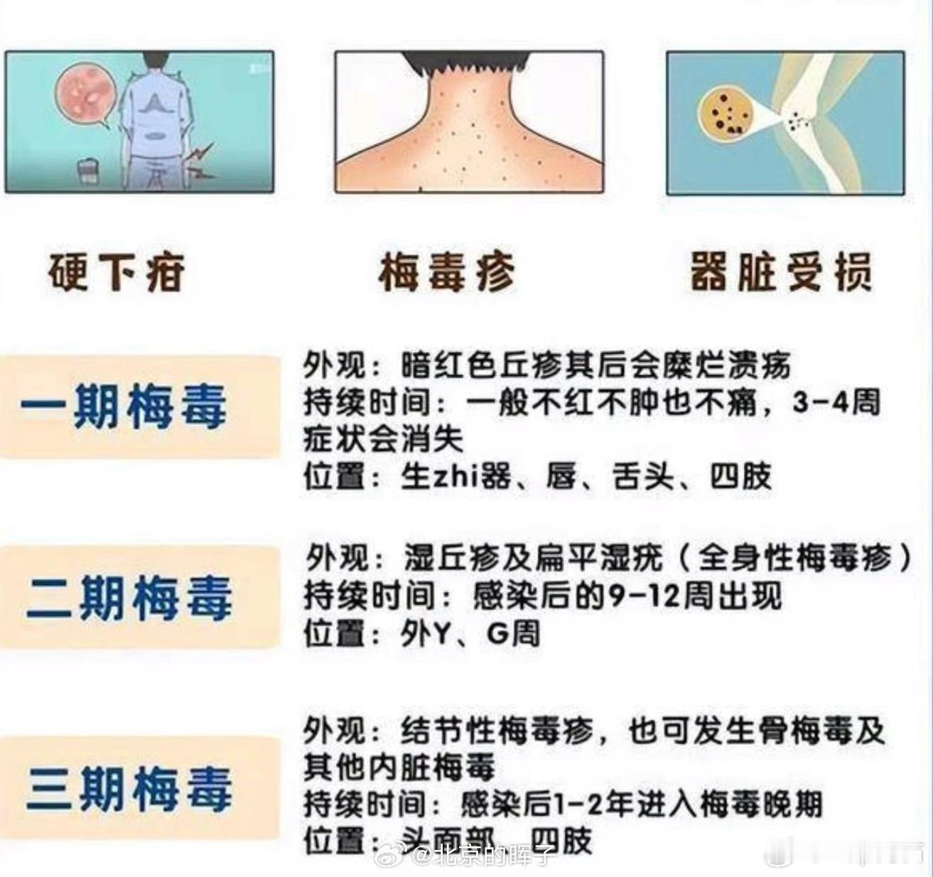 日本梅毒暴发与三个一有关日本梅毒病例12年暴涨超12倍，专家把根源指向“三个一”