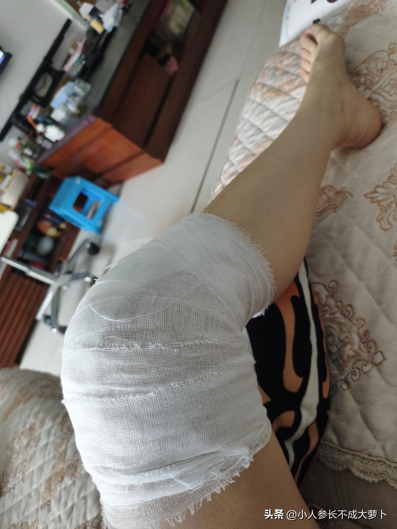 什么东西在真金白银的利益面前，真的可啥都不是了！
我们公司的一个员工，我腿刚受伤