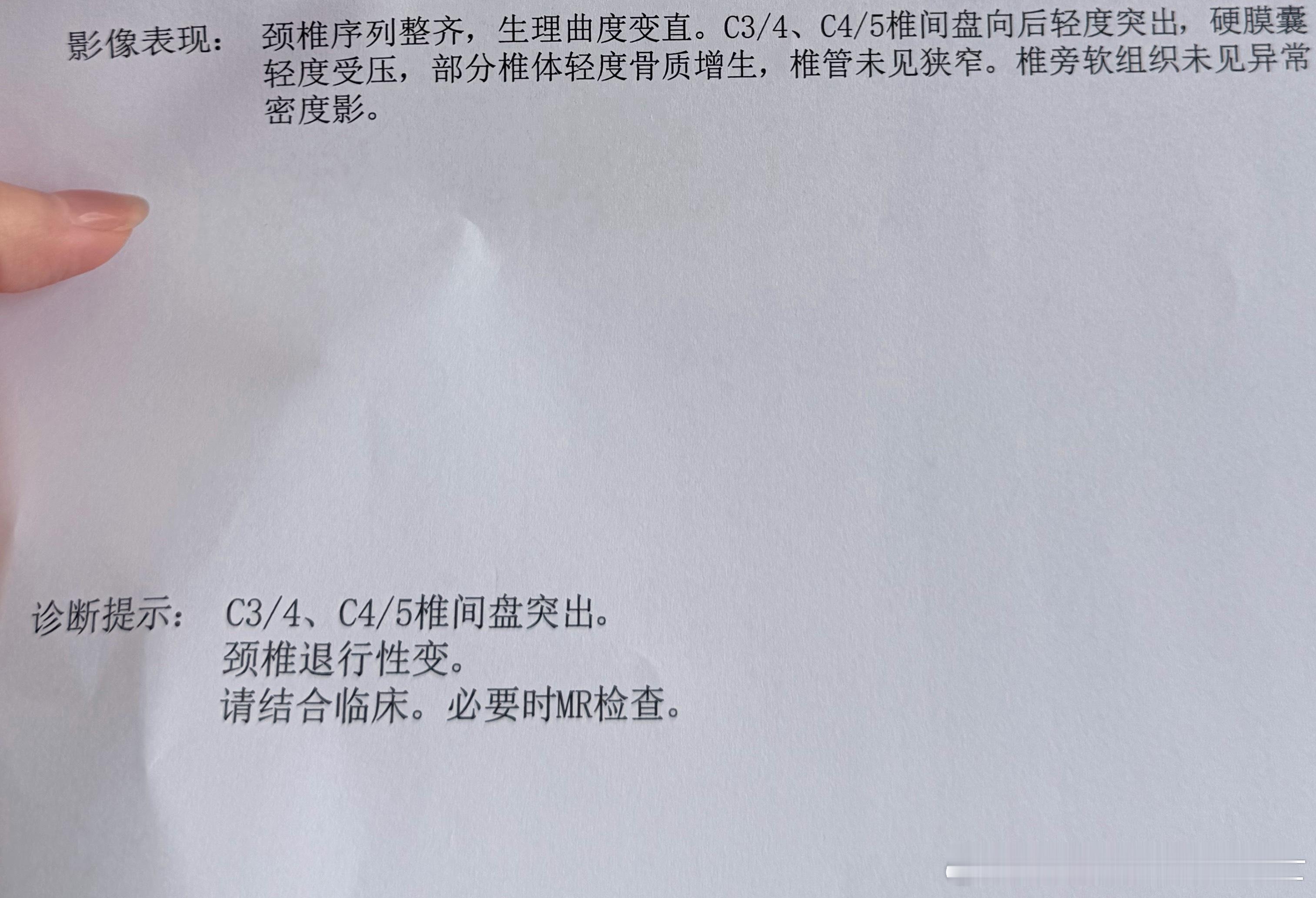 不是落枕🥹🥹，让我少玩手机少看电脑。 