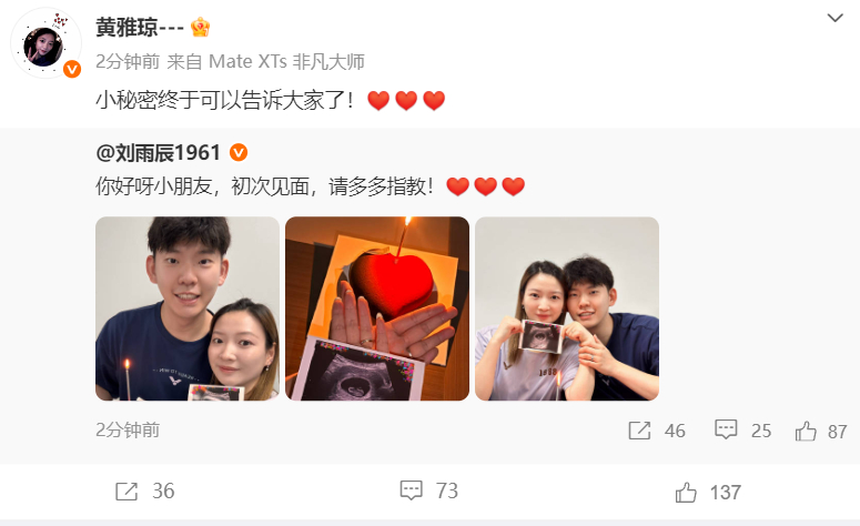 黄雅琼怀孕 ✌️恭喜雅琼！以前见到郑思维的艾登就很喜的雅琼，终于要迎来自己的宝宝