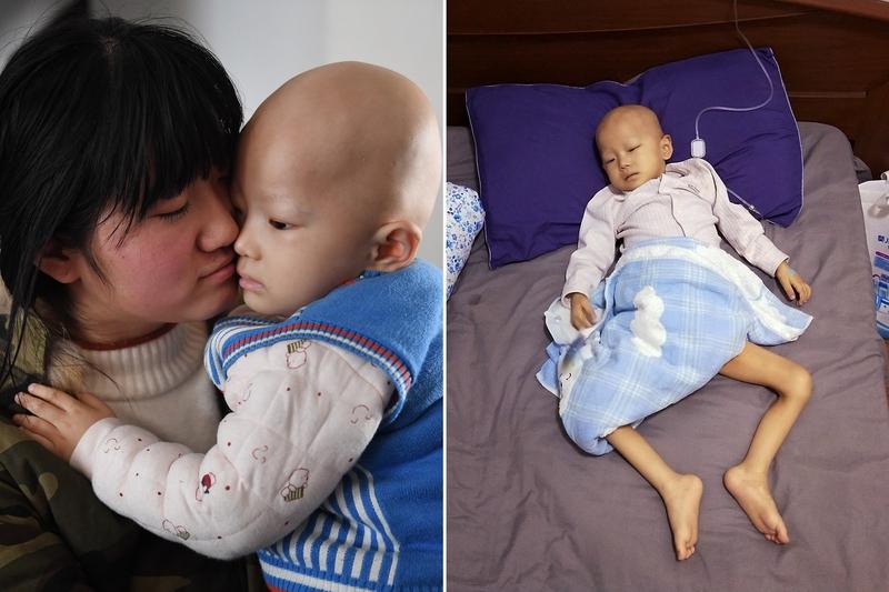 你觉得患癌后该不该倾家荡产治疗 患癌后该不该倾家荡产治疗，这真是个扎心的问题。癌