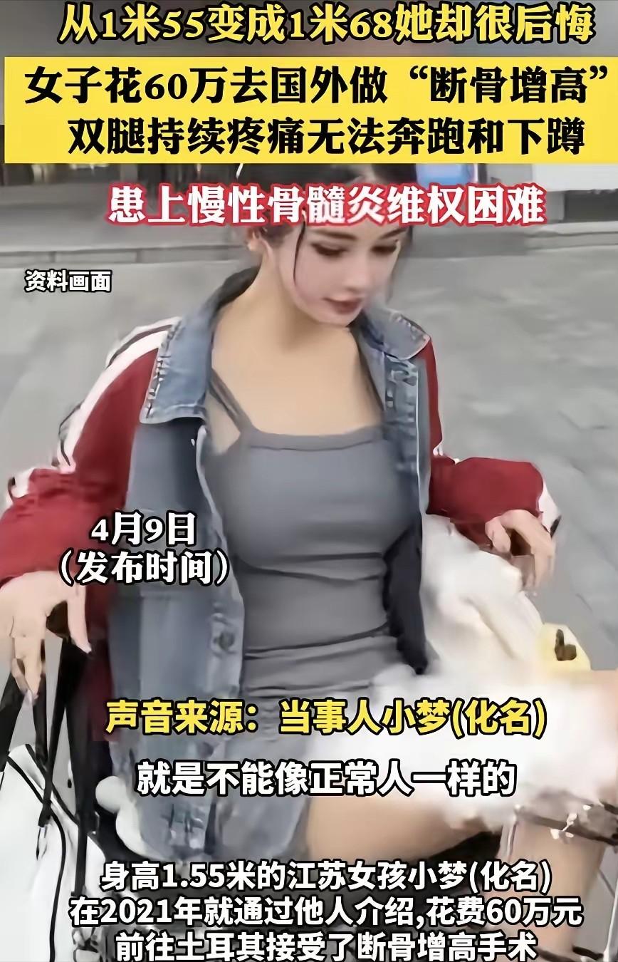 悲催了！江苏，一女子嫌自己1米55太矮，花60万去土耳其做断骨增高。术后半年小腿