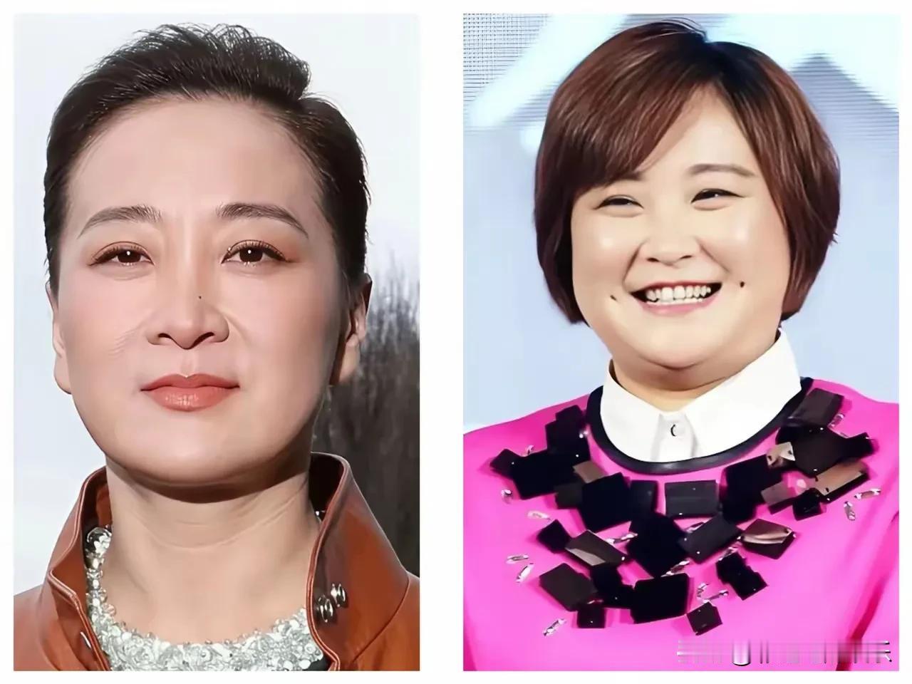 贾玲最大的变化是面相变了，以前见人三分笑自来熟观众缘老好了，现在自带疏离感，笑容