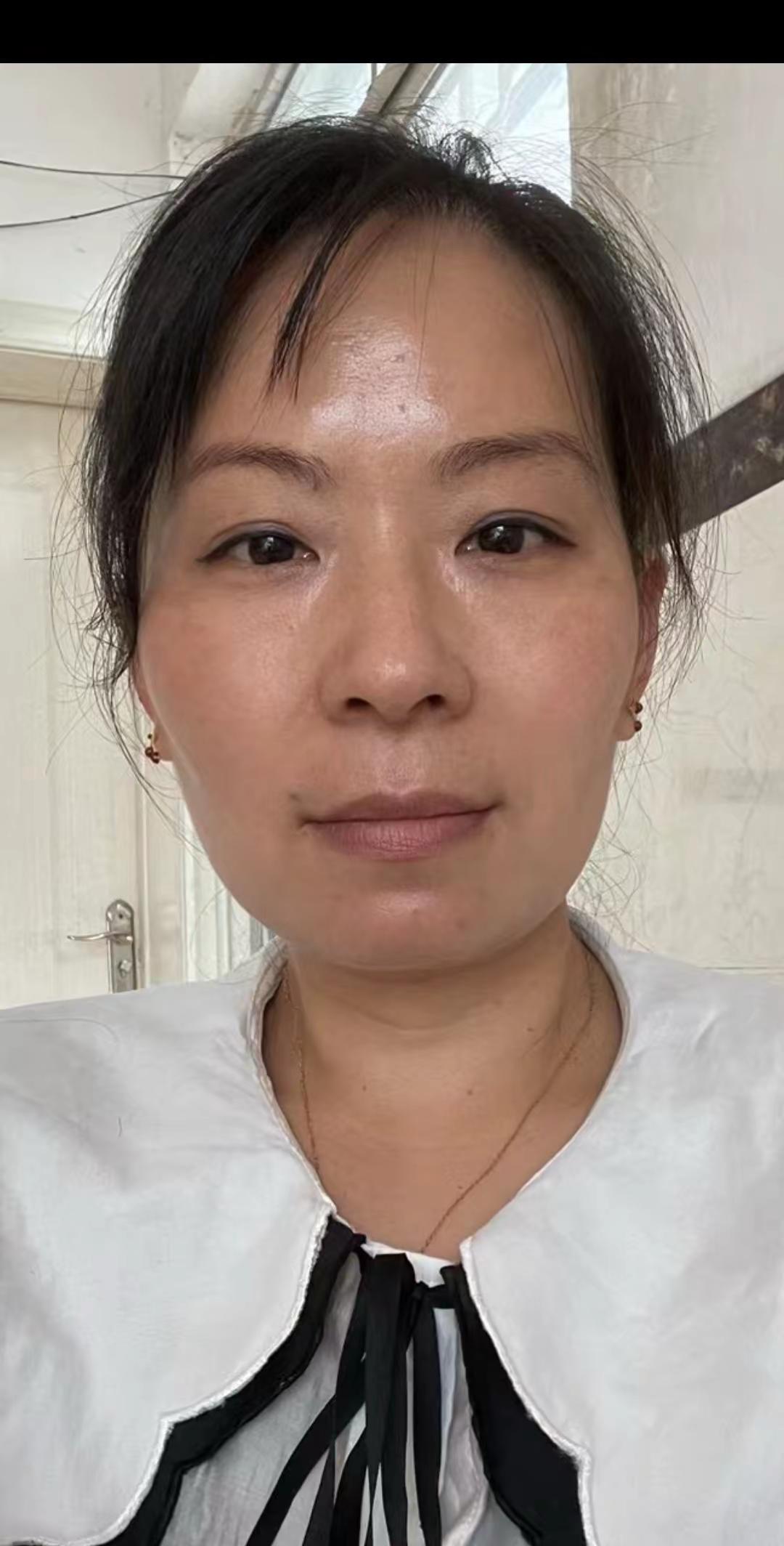 以前脸上的斑点，看着肤色暗沉发黄，出门总想着遮厚厚的粉底，不敢近距离拍照，连素颜