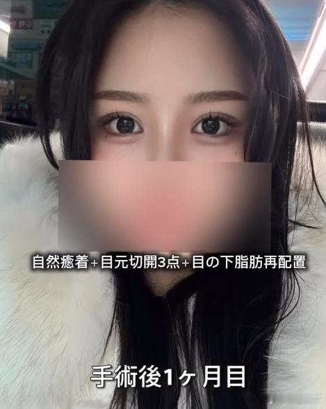 这个眼睛和脂肪重拍做的也好看 
