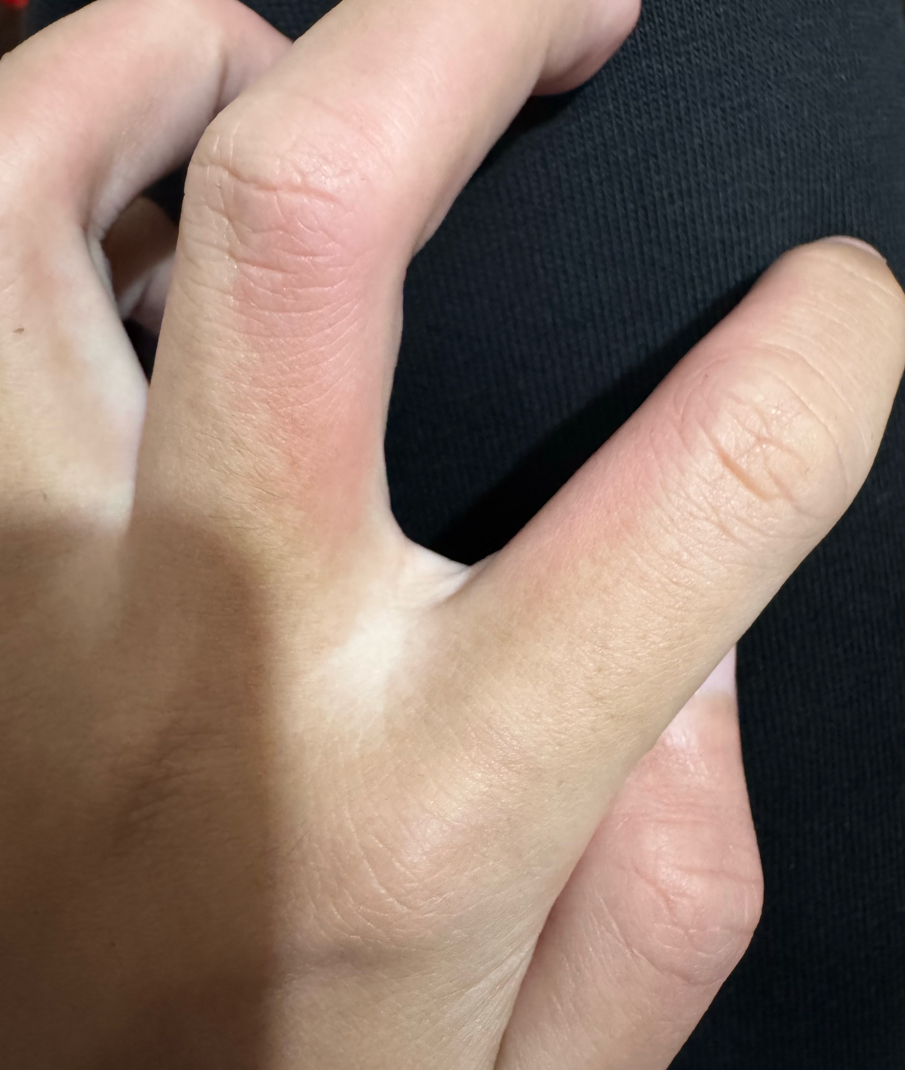 辣确实是痛觉，如果不相信的朋友去切个辣椒就能感受到了，我的双手现在真的是火辣辣的