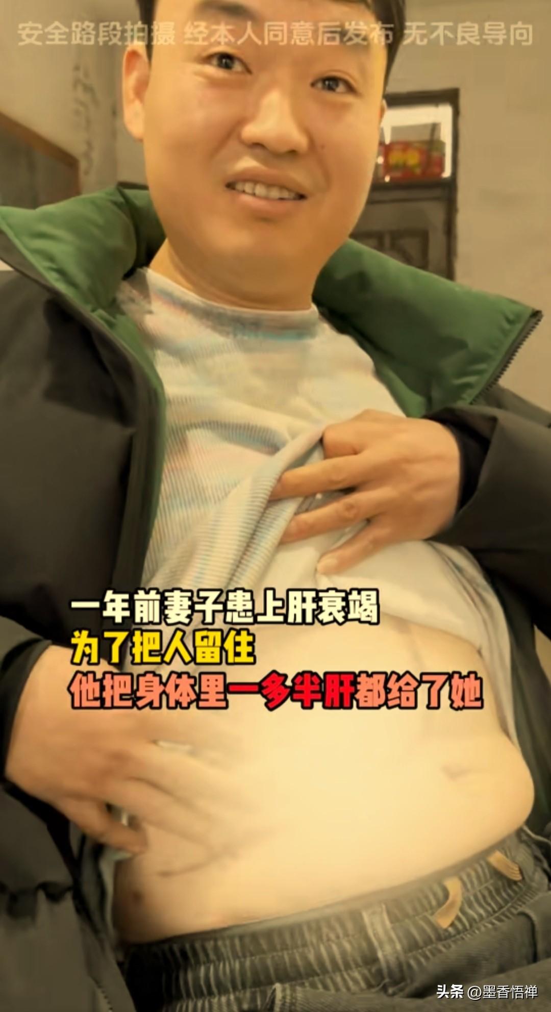 割肝救妻只换10个月团圆，他跪守ICU23小时：我这辈子最想救的人，从来都是你