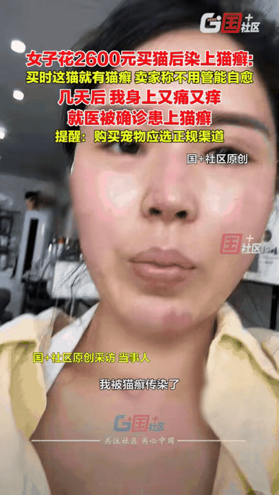 嘉兴女子花2600元买猫，踩坑踩得结结实实！
 
明知猫咪带癣，偏信卖家“能自愈