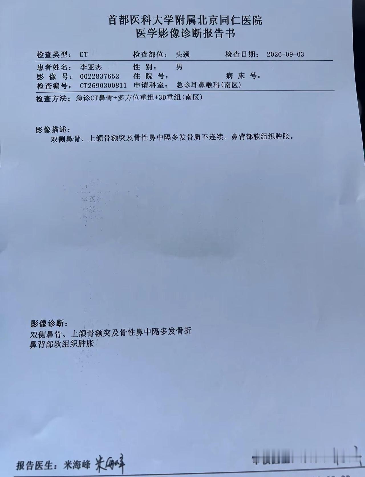 别人打篮球是变向过人，我打篮球是鼻子变向，本来长得就一般，现在雪上加霜了。最近也