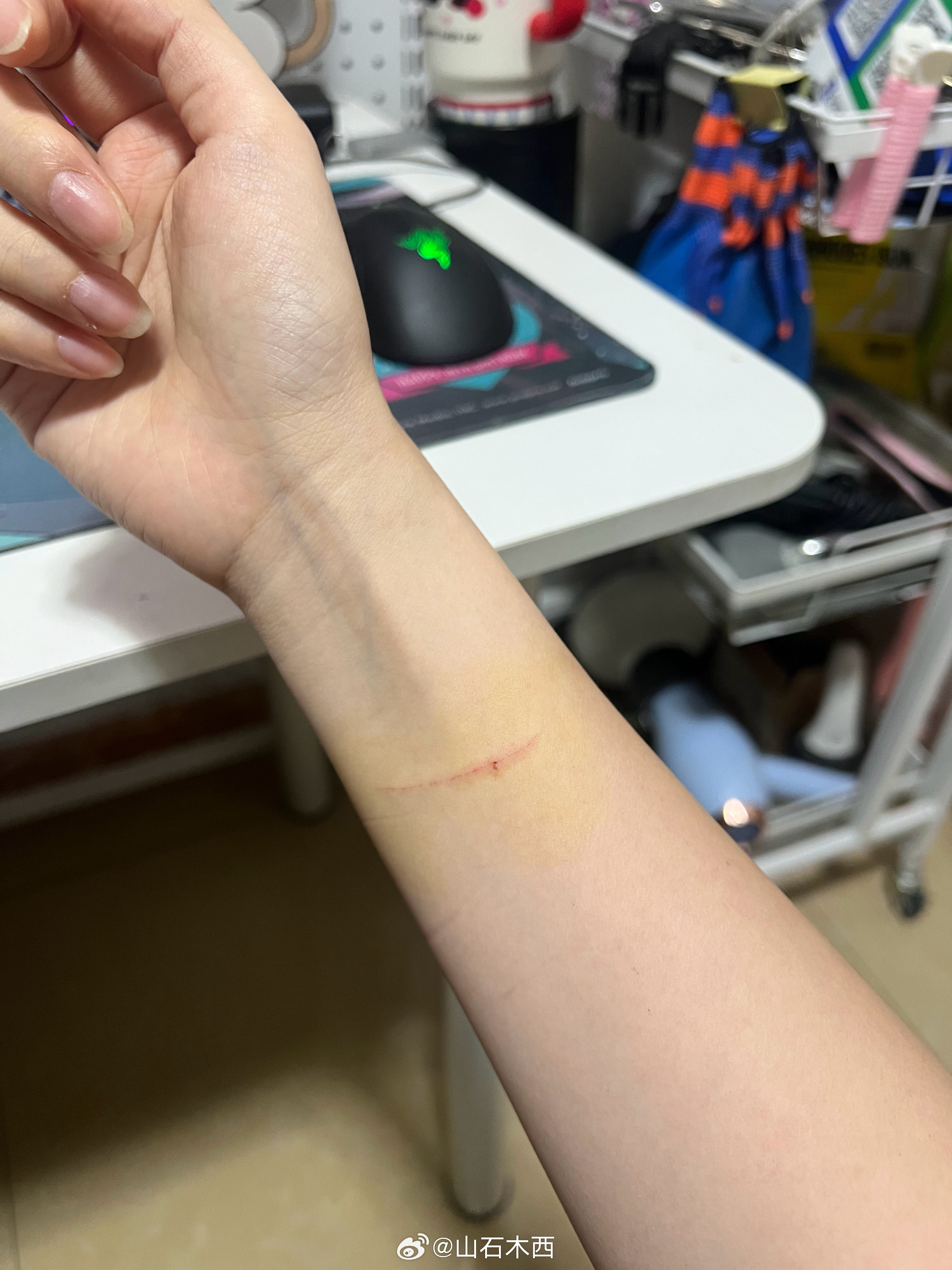 今天一天看着手腕这个其实挺吓人的罪魁祸首就这样在p2卖萌 