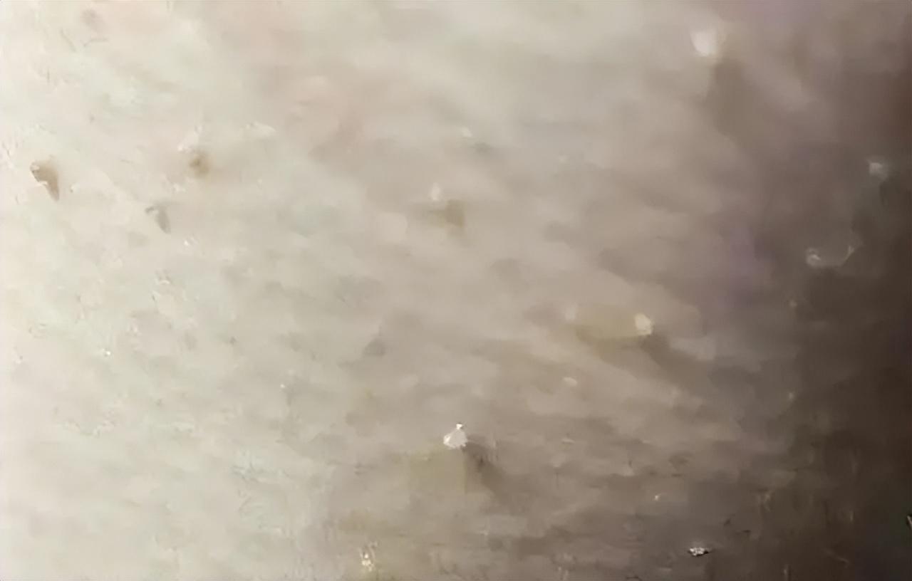免疫力低下的表现，
HPV是人类乳头瘤状病毒的英文缩写，也是女性宫颈癌的主要致病