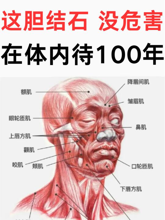 这胆结石，没危害，在体内待100年！