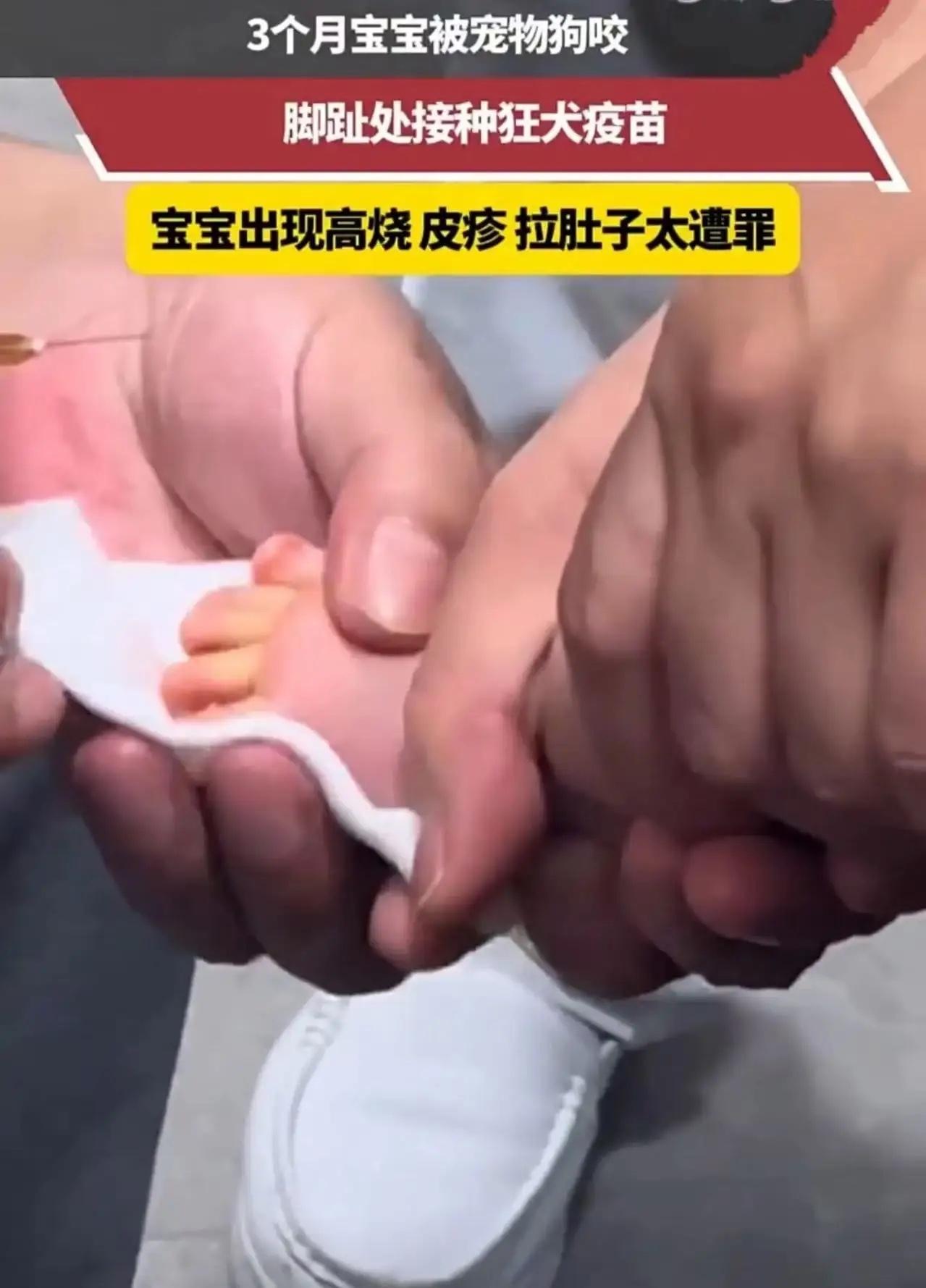 “这次养狗的后悔了！” 就因为家里养的狗“吃醋”，才三个月大的宝宝，硬生生遭了半