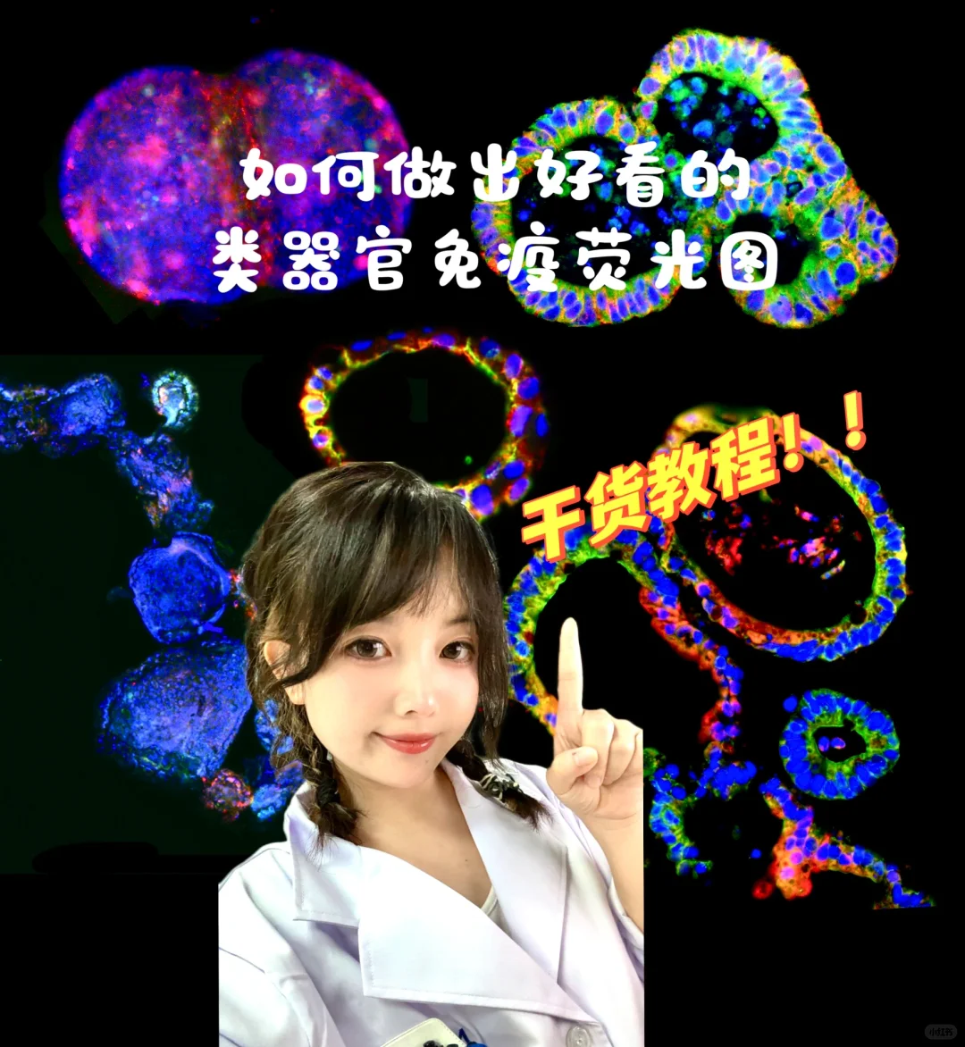 吐血整理！如何做出好看免疫荧光类器官图