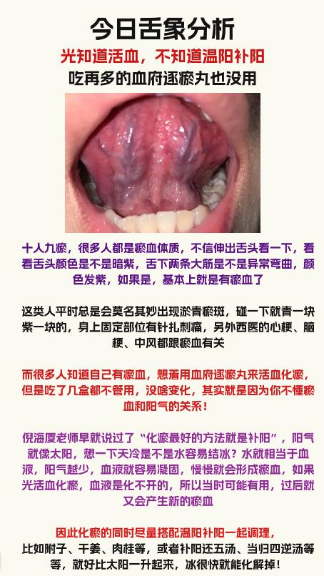 体内有血瘀，光活血化瘀，不温阳，吃再多血府逐瘀丸都没用！！！