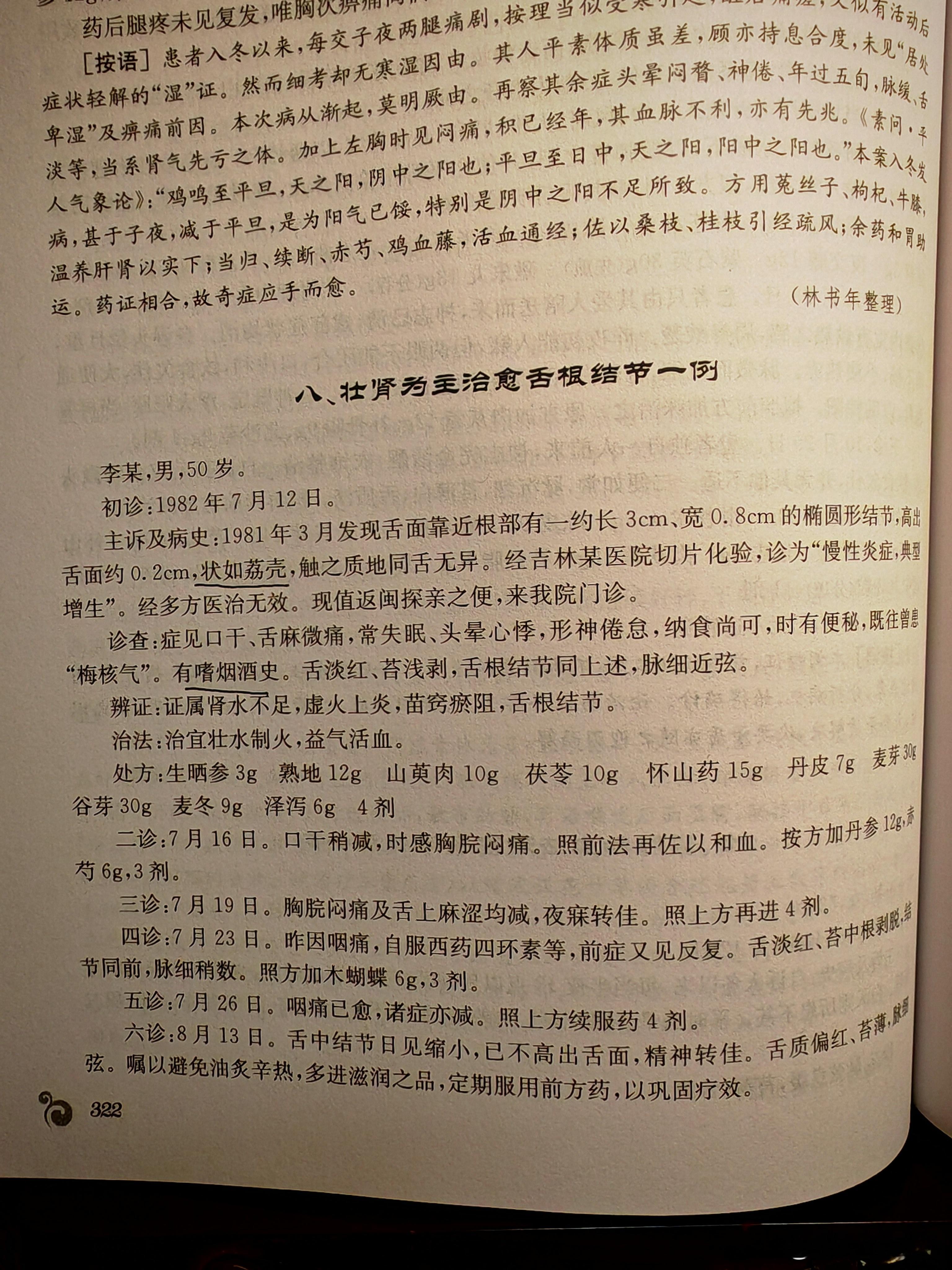 舌根椭圆形结节一年多，状如荔壳。平时用脑多度，常失眠，熬夜伤神，嗜烟酒。 