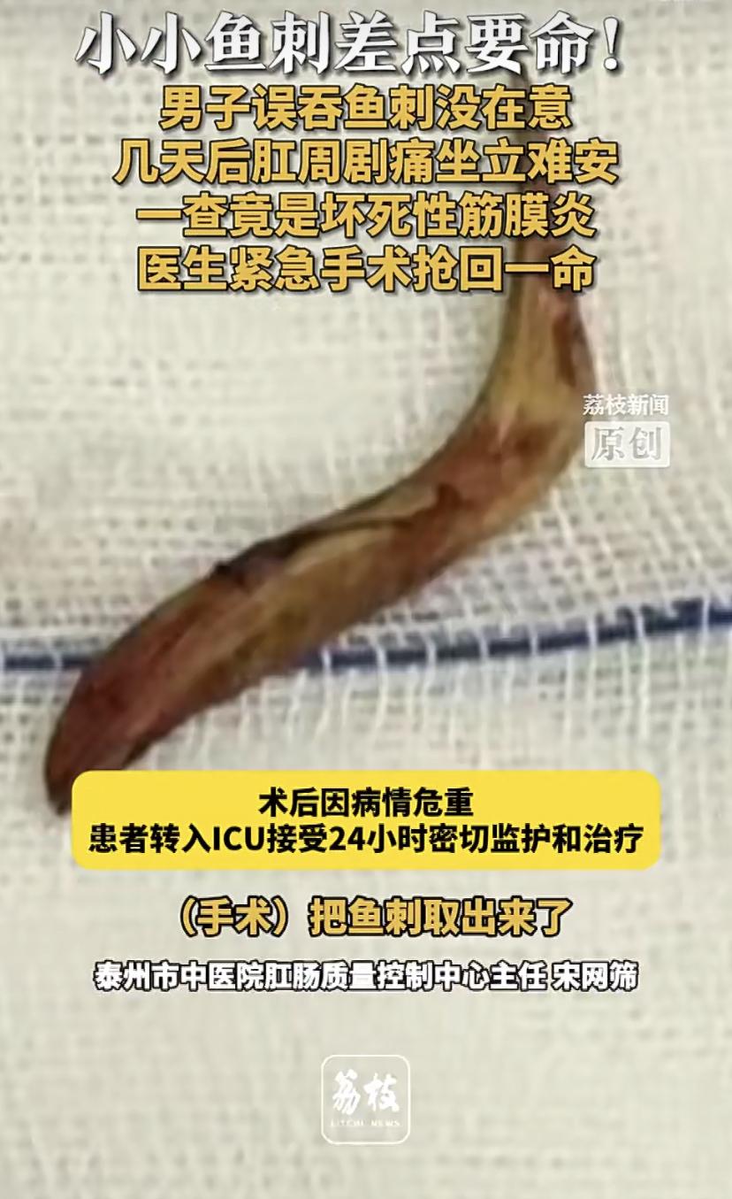 江苏一位卜先生最近差点因为一根鱼刺丢了性命。他前几天吃鱼时不小心吞了根刺，当时喉