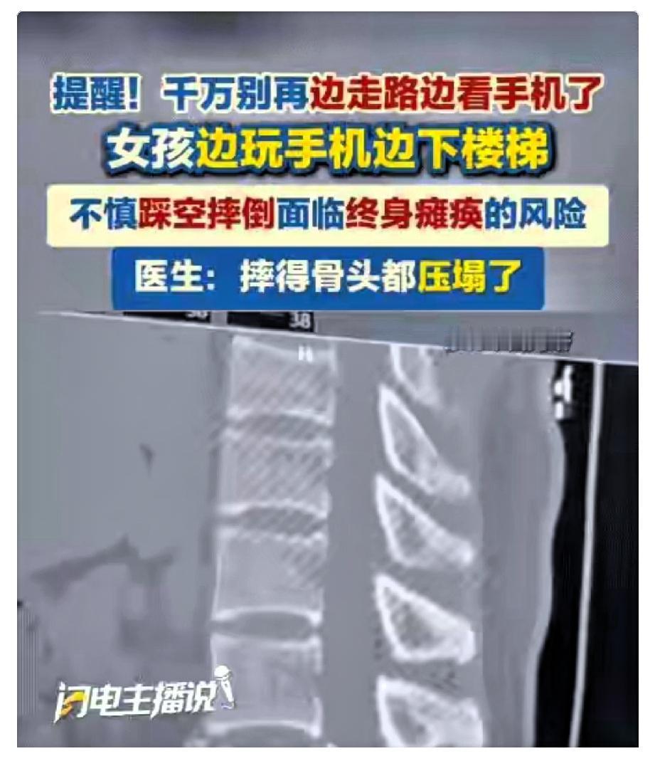 3秒！毁了一辈子！

在生活中，很多人都有一边走路一边看手机的习惯，甚至觉得这样