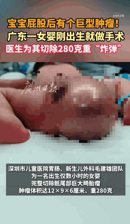 可怜天下父母心！广东深圳，一位孕妈在产检时惊觉胎儿屁股上长了个不该长的大疙瘩，全