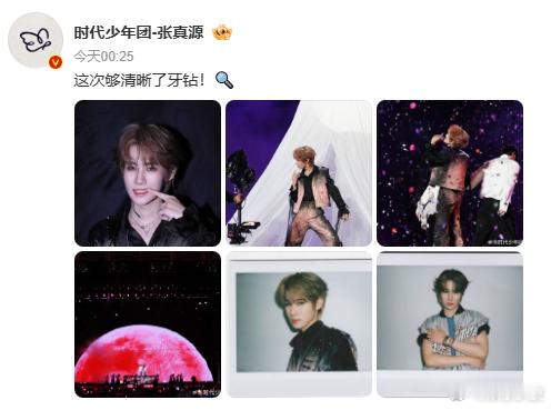 张真源牙钻这次够清晰了这次真的有看见张真源的牙钻啦还是超清晰得那种哈哈哈哈！ 2