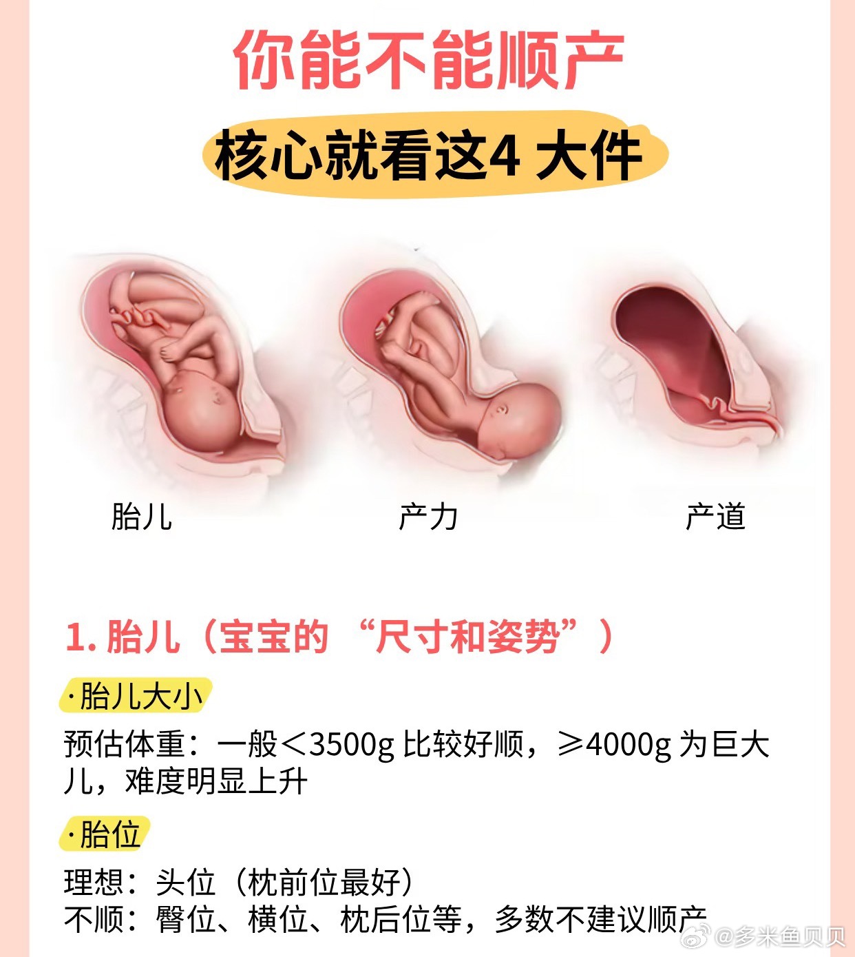 你能不能顺产？看这 4 点就够了 