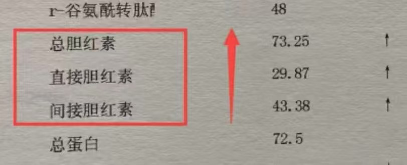 早点知道就好了，胆红素升高，这个危害很大 门诊上很多患者会说，胆红素升...