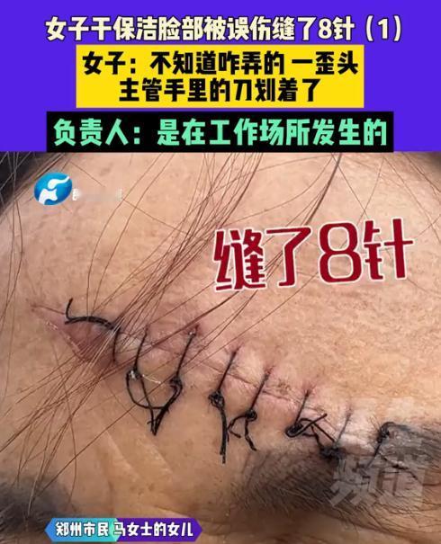 “太憋屈！”河南一位2000块工资的保洁，工作中脸部竟被领导用刀误伤，只送小诊所