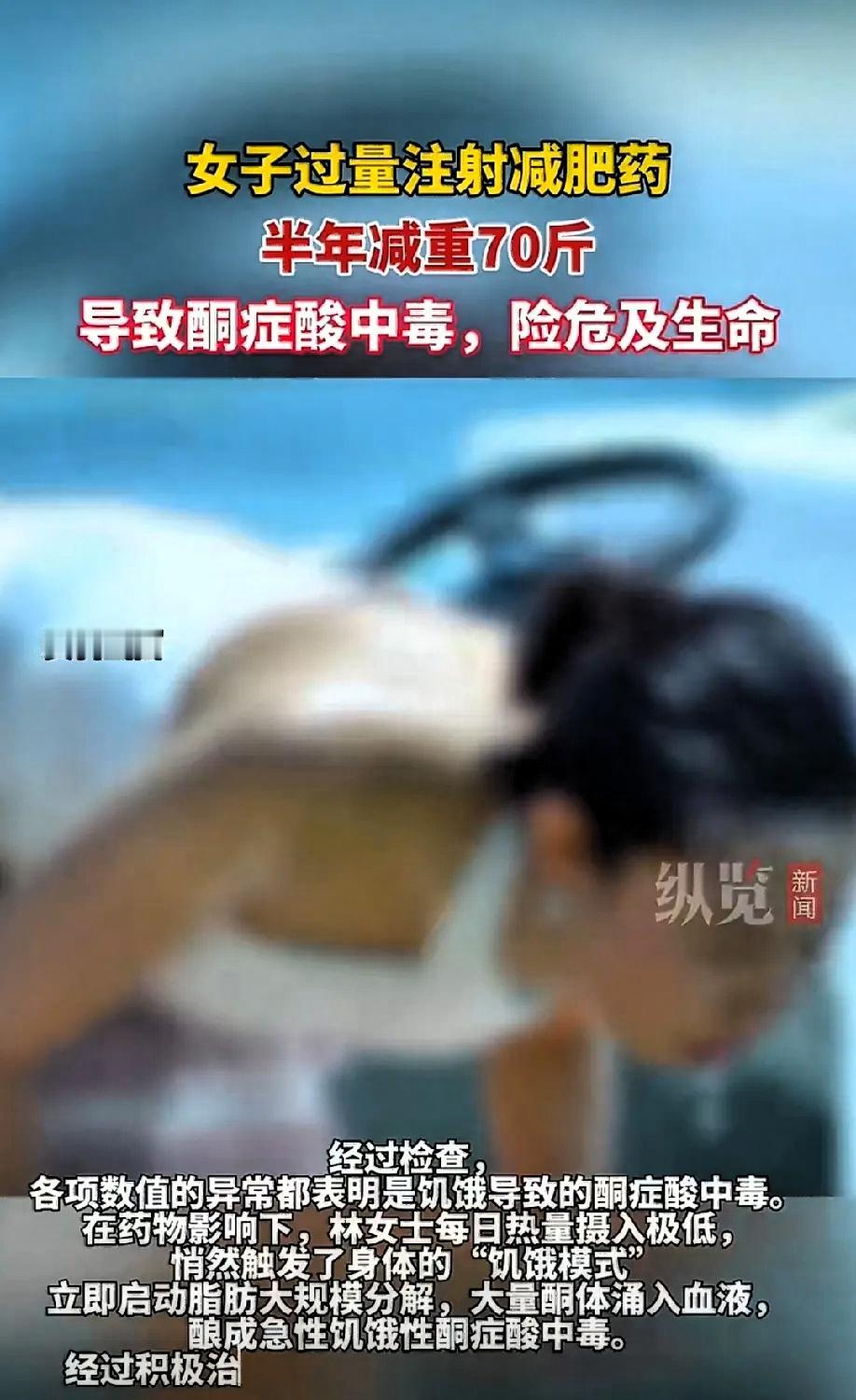 太惊心了！浙江林女士为了快速瘦下来，自行注射网红减肥药，半年内从160斤猛降到9