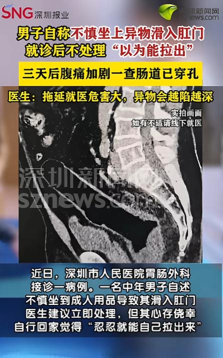 广东深圳，一男子不慎坐上异物，导致异物进入体内。男子赶紧去医院检查，医生建议尽快