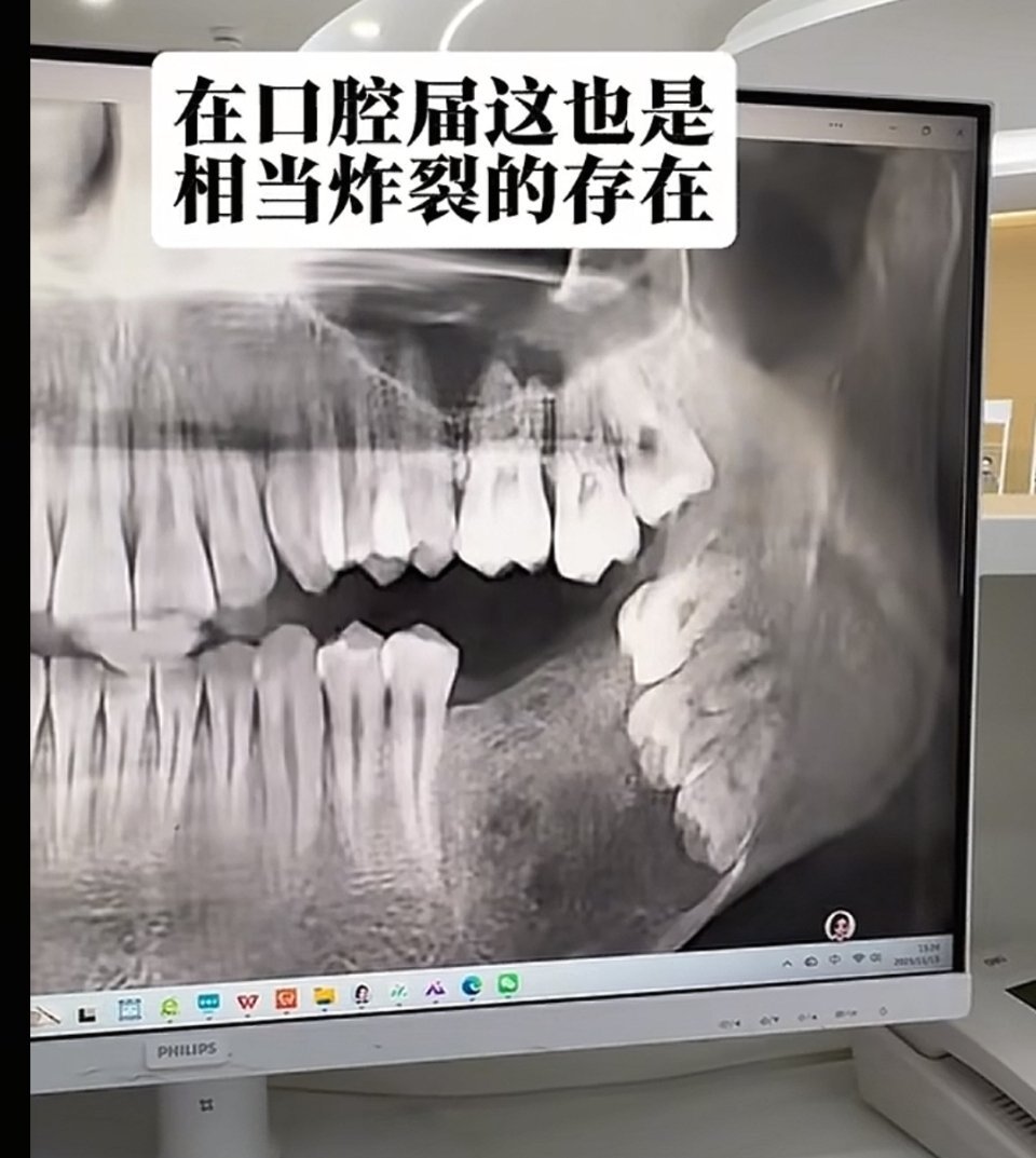 在口腔届也是相当炸裂的存在 