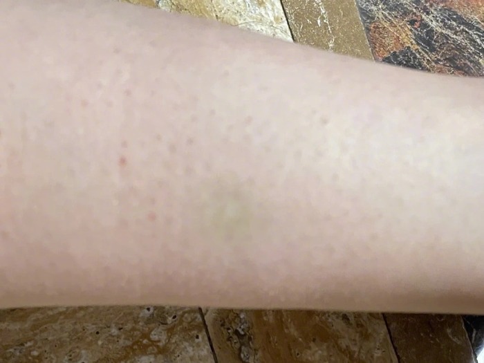 #养宠物猪追人拱人致邻居淤青#【#物业回应业主养宠物猪致邻居淤青#】日前，湖南长