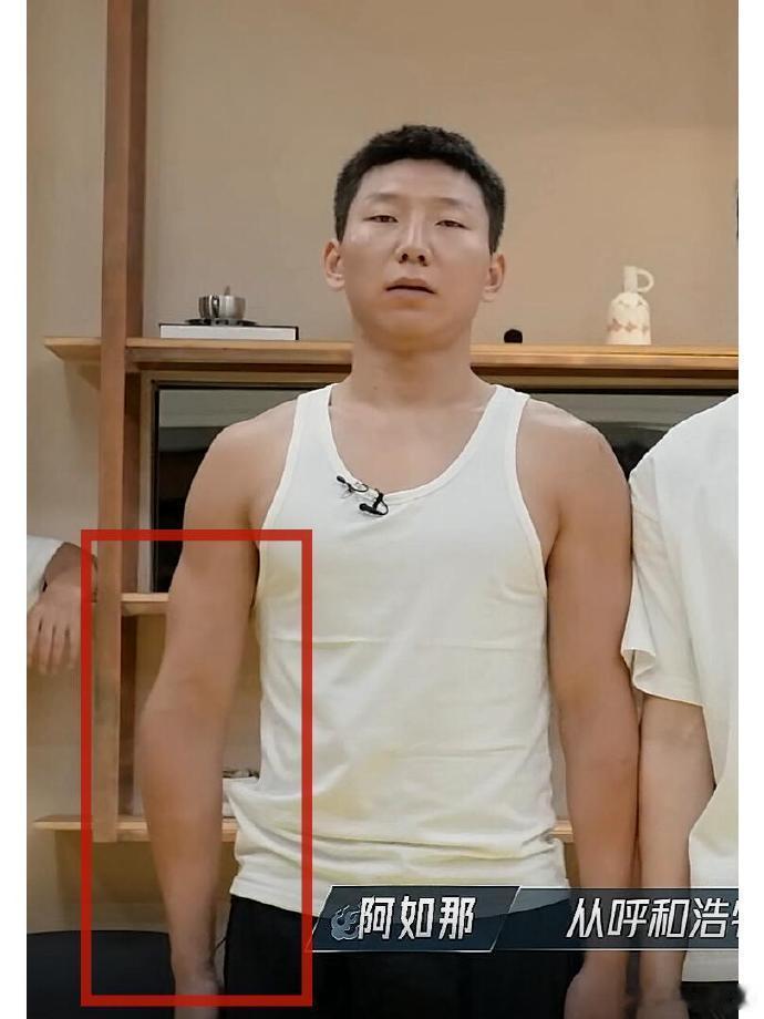 #阿如那手臂外翻#阿如那的手臂变形了，像是骨折没处理好的样子，看着有点心疼啊！！