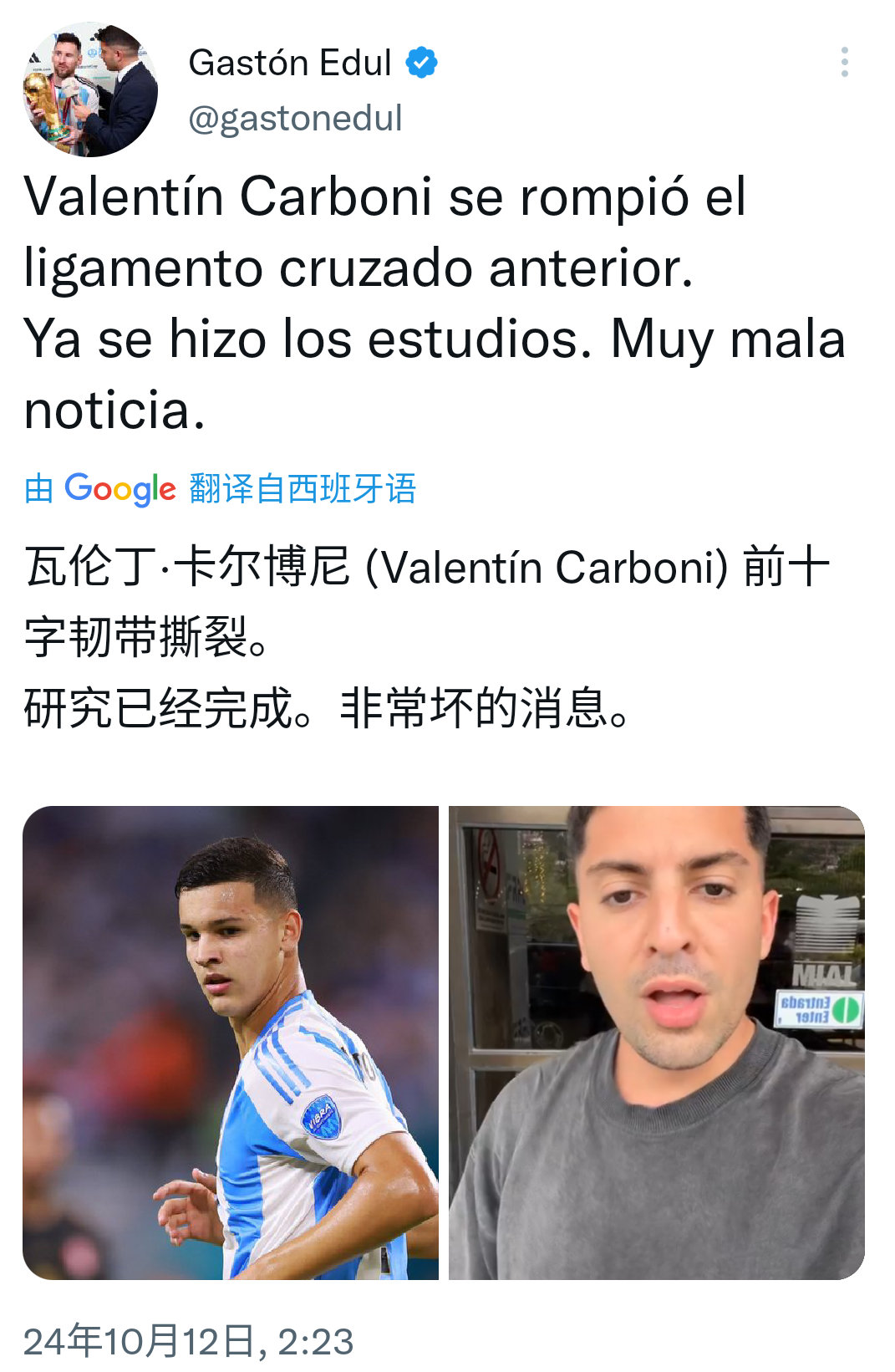 🚨🚑最新消息：瓦伦丁·卡尔博尼前十字韧带撕裂。非常坏的消息。😧😧😧#卡