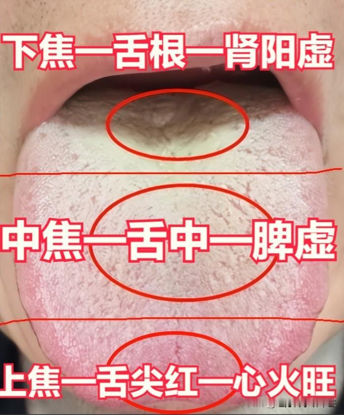经常上火，黄连上清芄、牛黄解毒芄、三黄片应该怎么选？

1、黄连上清芄
功效：散