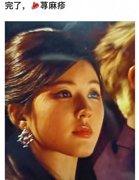 #赵露思疑似荨麻疹复发#  12月17日，有网友发现在星光大赏直播镜头里，赵露思