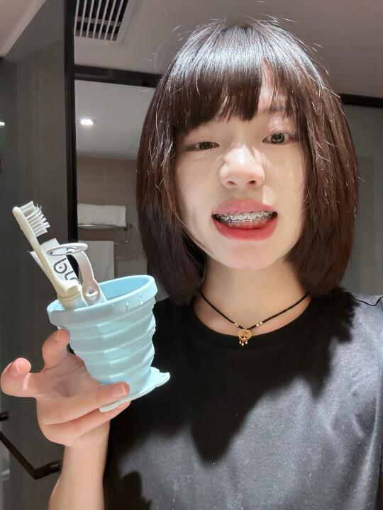 我真的很爱我的钢牙！！