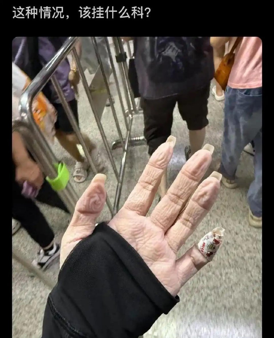 但是没有指纹的手，更好识别吧。 