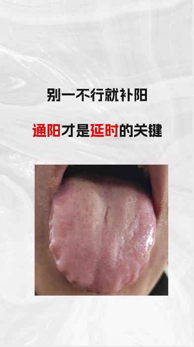 别一不行就 “补阳” ，“ 通阳 ”才是延时的关键