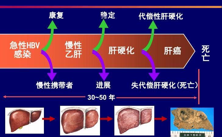 肝硬化患者别灰心！中医调理让你远离肝硬化，坚持一辈子不反复！
大家好，我是北京公