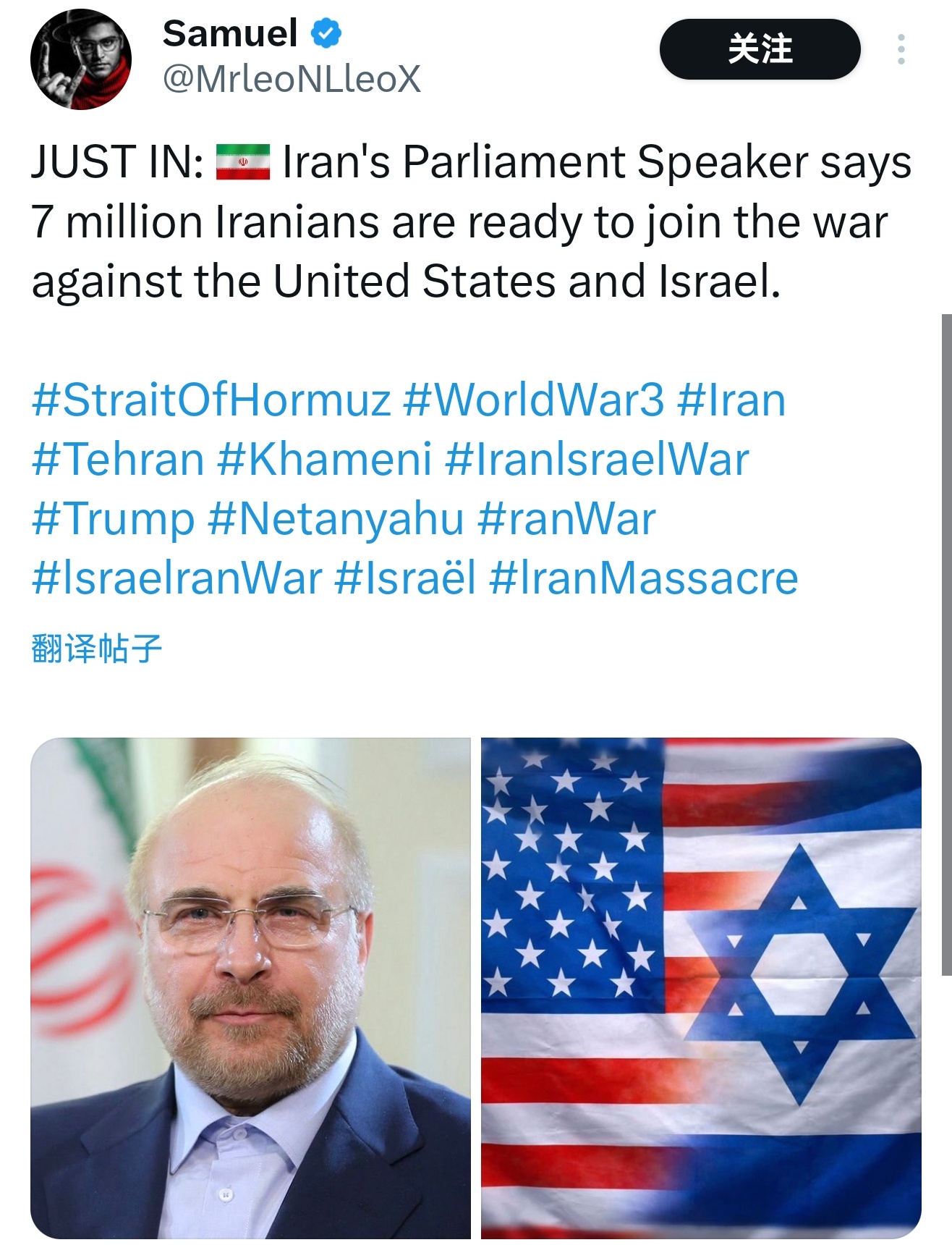 美国头大了📢：“伊朗议会议长表示，700万伊朗人已准备好加入对抗美国和以色列的