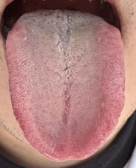 日常养护不到位，身体状态难免受影响，海绵体养护别忽视






不少朋友因为手